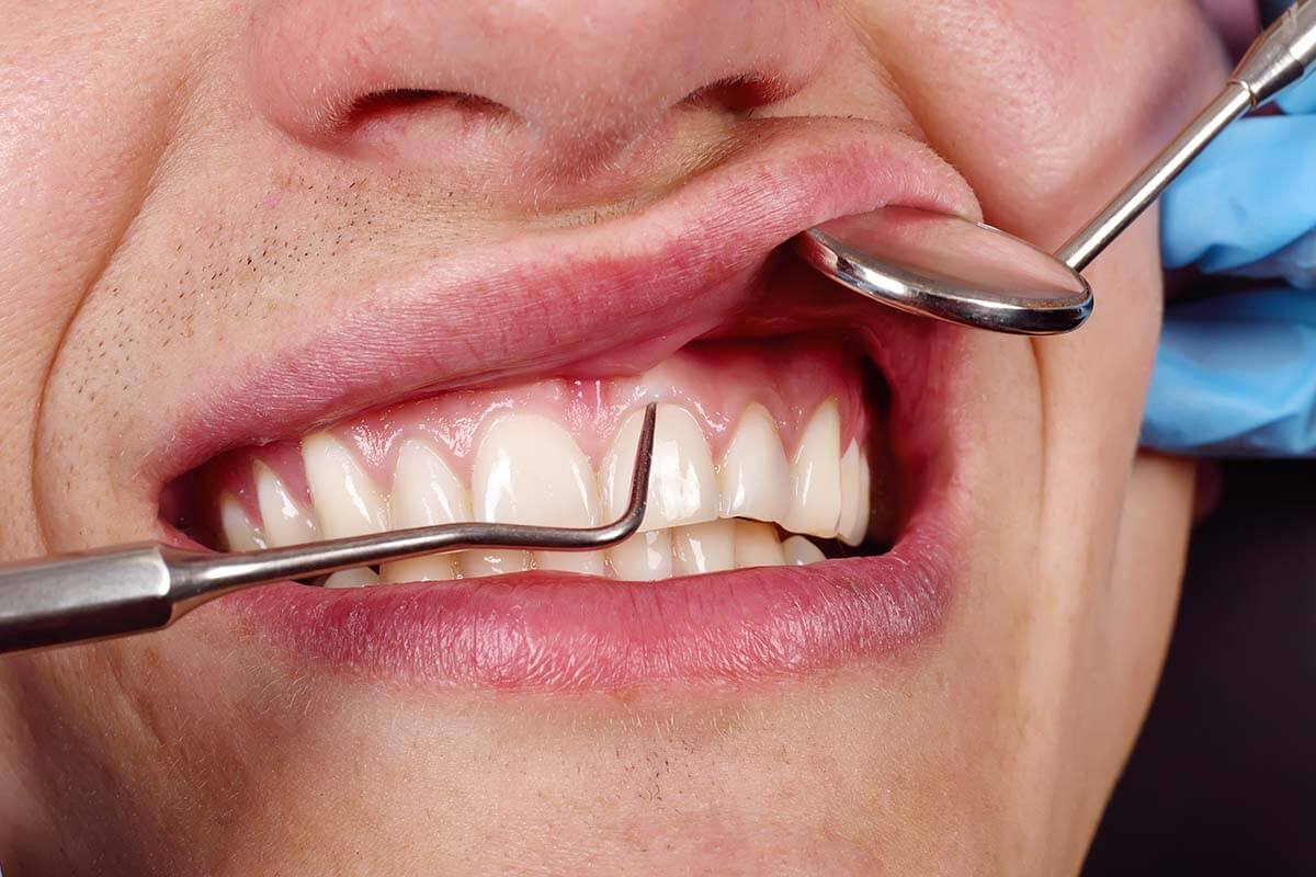 Periodontic Care